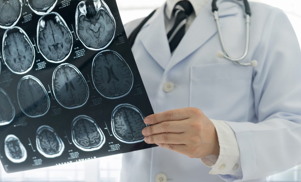 Image of a doctor holding the MRI results of a brain scan